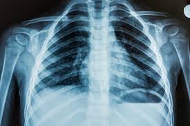 X-ray Imaging